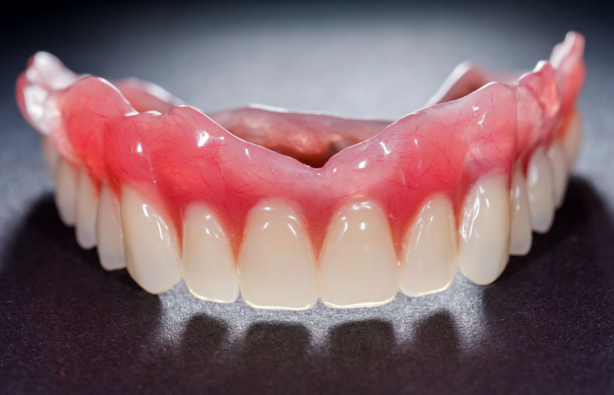 dental crown placement